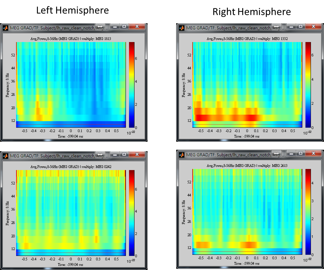 TimeFrequency_at_Channel_1813_0242_1332_2613